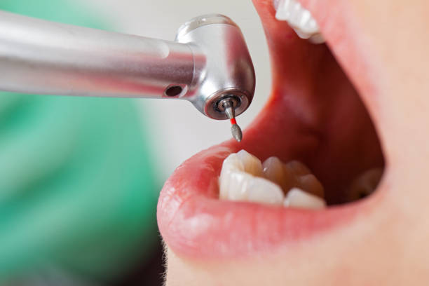 Best Emergency Care for Gum Disease in Edina, MO